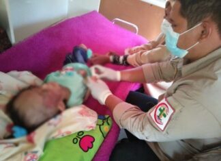 Anak usia tujuh tahun menderita marasmus malnutrisi di Pangkep.(Ist).